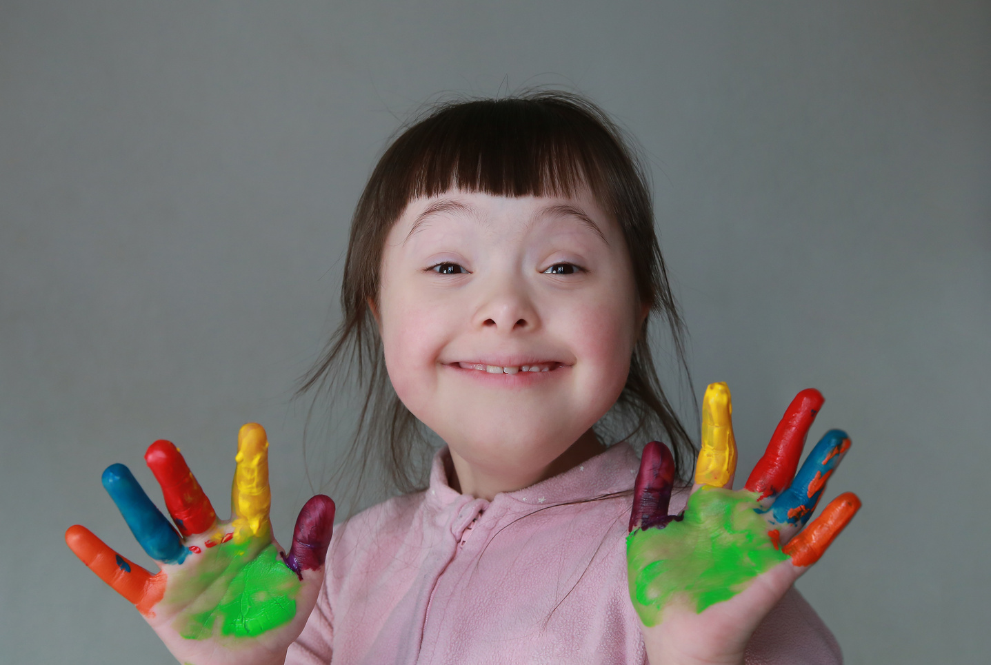 Little Girl with Down Syndrome Showing Hands with Paint